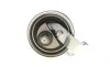 Комплект ГРМ Audi A3/A4/A6/TT/Skoda Octavia/VW Golf 1.8T 96-10 (23x150z) BOSCH 1 987 946 347 (фото 6)