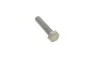 Комплект ГРМ + помпа Citroen Berlingo/Jumper/Peugeot Boxer/Expert/Partner 2.0HDi 98-09 (25x141z) Contitech CT987WP1 (фото 16)