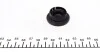 Комплект цепи ГРМ MB C-class (W203/S203)/E-class (W211/S211) 3.5 04-11) (z=216) FEBI BILSTEIN 44963 (фото 5)