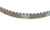 Комплект ГРМ Land Rover Discovery/Range Rover 2.7D 04- (82zx20) HEPU 20-2079 (фото 4)