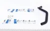 Патрубок радиатора Audi 80/90/100 1.3-2.8 72-96 IMPERGOM 221013 (фото 1)