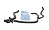 Патрубок системы охлаждения Ford Transit 2.2TDCi 06-14 (к-кт в сборе) IMPERGOM 221787 (фото 1)