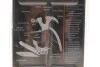 Мультиинструмент 13in1 (мультитул) Neo-tools 63-113 (фото 2)