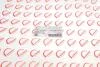 Крышка двигателя (передняя) Ford Transit 2.4 TDCi 00-06 ROTWEISS RWS1919 (фото 4)