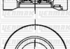 Поршень с кольцами і пальцем (размер отв. 75,00 /STD) CITROEN 1.6HDI 05- (4цл.) (1.6 HDI (DV6C) 9HE/DV6BDM/9HF/9HL/9HR/DV6C / 95-11…) YENMAK 31-04496-000 (фото 1)
